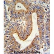 Ribosomal Protein L17 (RPL17) Antibody