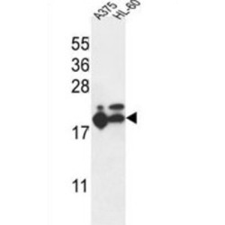 Ribosomal Protein L17 (RPL17) Antibody