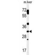 TBC1 Domain Family Member 7 (TBCD7) Antibody