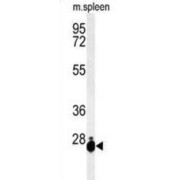 WB analysis of Mouse spleen tissue lysate (35 µg/lane), using THOC7 Antibody.