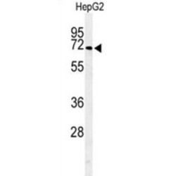 Arylsulfatase I (ARSI) Antibody