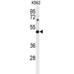 Galactosylgalactosylxylosylprotein 3-Beta-Glucuronosyltransferase 1 (B3GAT1) Antibody