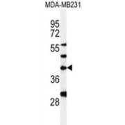 Dolichyl Phosphate-N-Acetylglucosaminephosphotransferase 1 (DPAGT1) Antibody