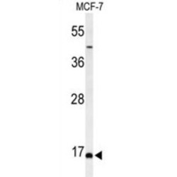 FAM44B Antibody