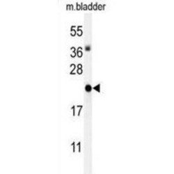 DNA-Binding Protein Inhibitor ID-4 (ID4) Antibody