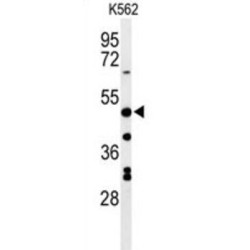 Ammonium Transporter Rh Type B (RHBG) Antibody