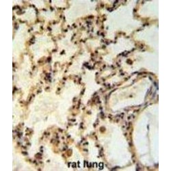 Mitochondrial Inner Membrane Protease Subunit 2 (IMP2L) Antibody