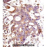 Catenin Beta 1 (CTNNB1) Antibody