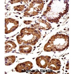 Catenin Beta 1 (CTNNB1) Antibody