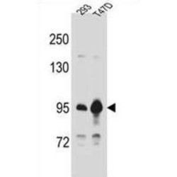 Catenin Beta 1 (CTNNB1) Antibody