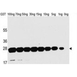 Glutathione S-Transferase (GST) Antibody