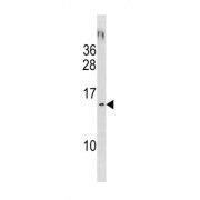 WB analysis of NCI-H292 cell lysates.