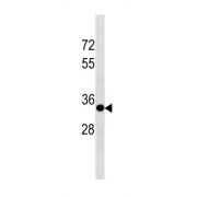 Sprouty RTK Signaling Antagonist 3 (SPRY3) Antibody