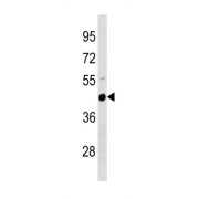 Mouse Plau Antibody