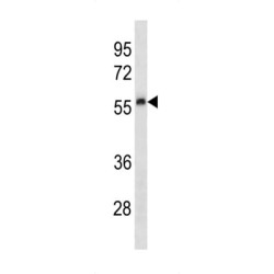 Mouse Plau Antibody