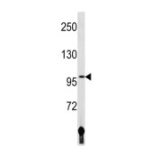 DNA Ligase 4 (LIG4) Antibody