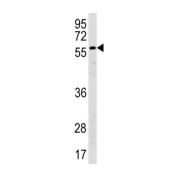 Plexin Domain Containing 2 (PLXDC2) Antibody