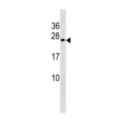 WB analysis of A549 cell line lysates.