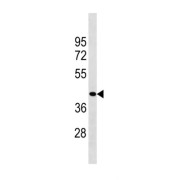 Zinc Finger CCHC Domain-Containing Protein 3 (ZCCHC3) Antibody