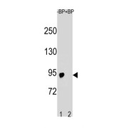 Solute Carrier Family 21 Member 19 (SLCO6A1) Antibody