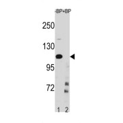 Inhibitor of Nuclear Factor Kappa-B Kinase Subunit Beta (IKKB) Antibody