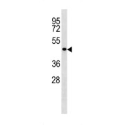 Cellular Tumor Antigen P53 (TP53) Antibody