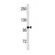 Insulin Receptor (INSR) Antibody