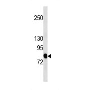 Amyloid Beta Precursor Protein Binding Protein B2 (APBB2) Antibody