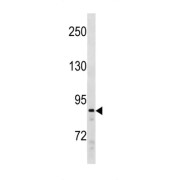 Polycomb Protein SUZ12 (SUZ12) Antibody