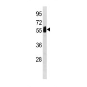 Carboxypeptidase, Vitellogenic Like (CPVL) Antibody