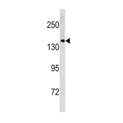 Protocadherin 11 Y-Linked (PCDH11Y) Antibody