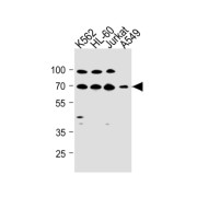 Gamma-Aminobutyric Acid Receptor Subunit Theta (gABRQ) Antibody