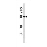 Immunoglobulin Superfamily Member 21 (IGSF21) Antibody