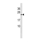 Protein CutA (CUTA) Antibody