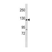 Ankyrin Repeat And SAM Domain-Containing Protein 1A (ANKS1A) Antibody