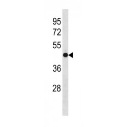 Olfactomedin 3 (OLFM3) Antibody