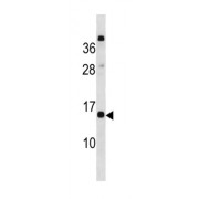 C-Type Lectin Domain Family 19 Member A (CLEC19A) Antibody