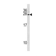 Interferon Alpha 8 (IFNA8) Antibody