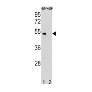 G2/mitotic-Specific Cyclin-B1 (CCNB1) Antibody