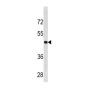 Cyclin B2 (CCNB2) Antibody