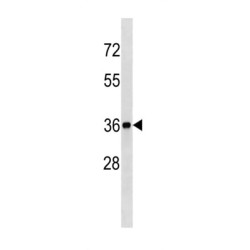 Biliverdin Reductase A (BLVRA) Antibody