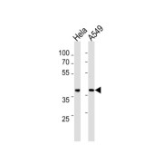 DNA Excision Repair Protein ERCC-1 (ERCC1) Antibody