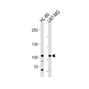 MORC Family CW-Type Zinc Finger Protein 3 (MORC3) Antibody