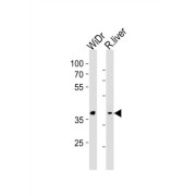 G-Protein Coupled Receptor 4 (GPR4) Antibody