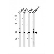 Zinc Finger Protein Gfi-1b (GFI1B) Antibody