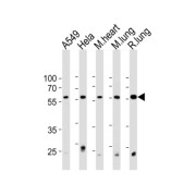 PRS4 Antibody