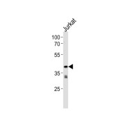 Trace Amine Associated Receptor 2 (TAAR2) Antibody