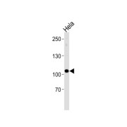 Ubiquitin-Protein Ligase E3C (UBE3C) Antibody