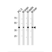 Cdk5 And Abl Enzyme Substrate 2 (CABLES2) Antibody