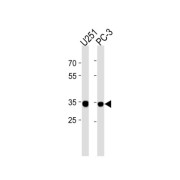 RPLP0P6 Antibody